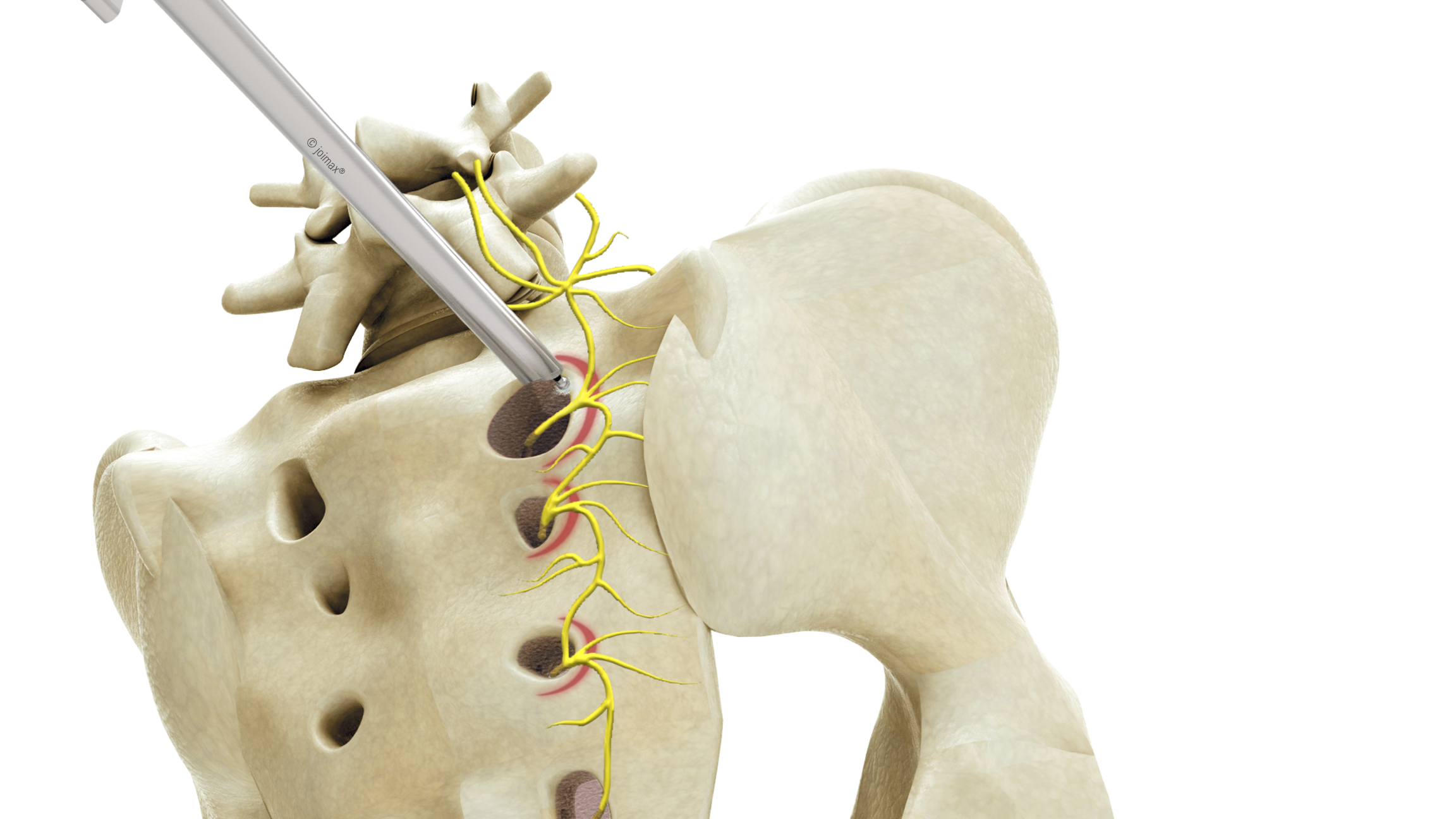 SIG Anatomie SIG Anatomie